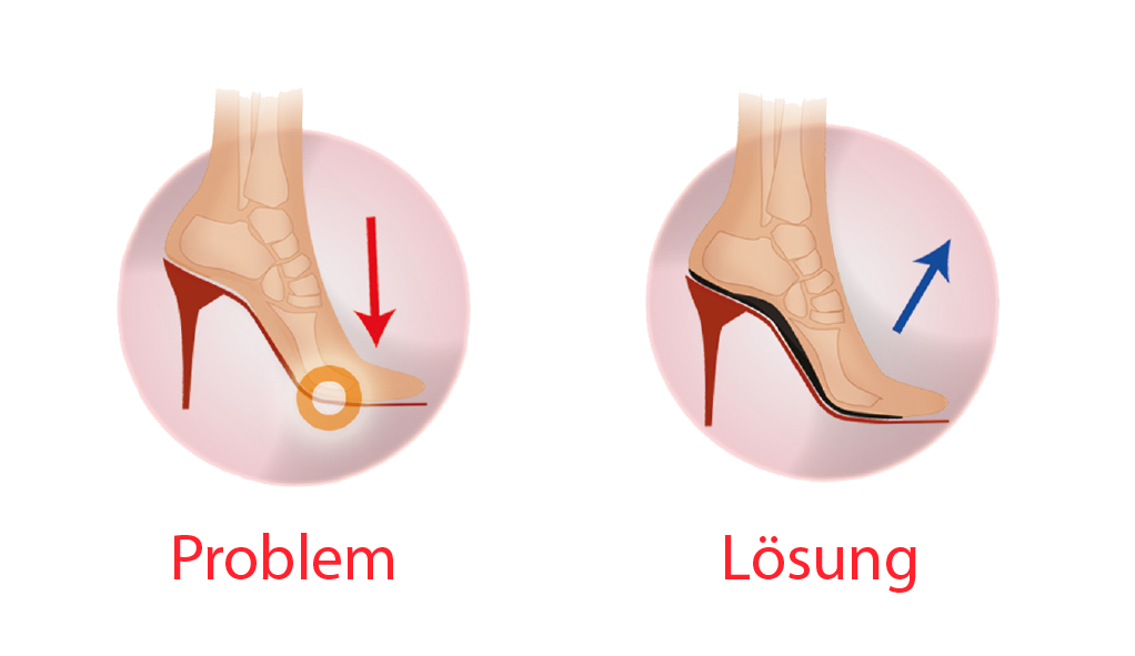 Footlogics High Heel Comfort in offenen Absatzschuhen? Ja, das geht!