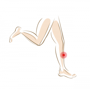 Shin-splints